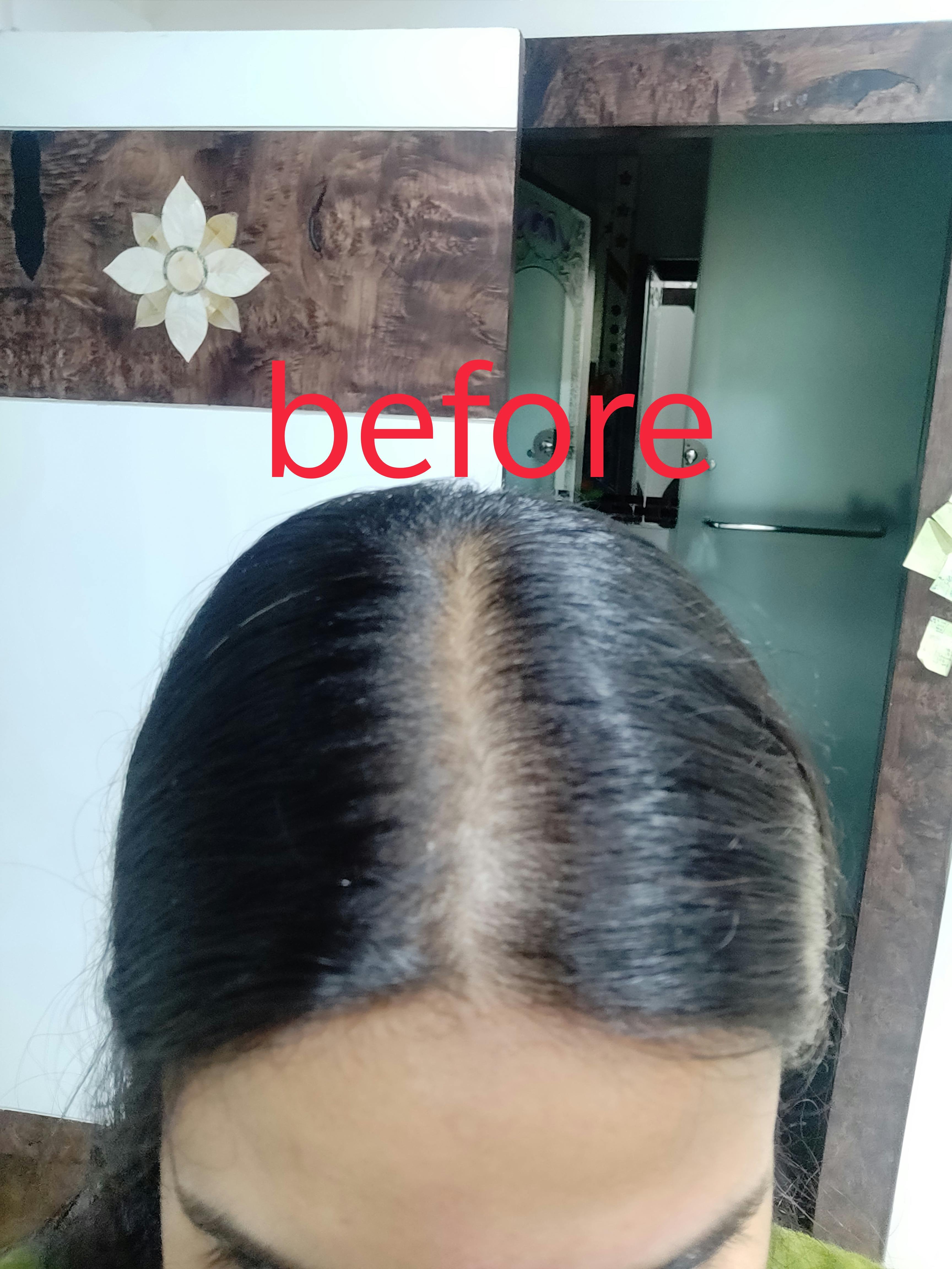 Side Patches Hair Extensions In India Invisible Side Patches 1 Hair