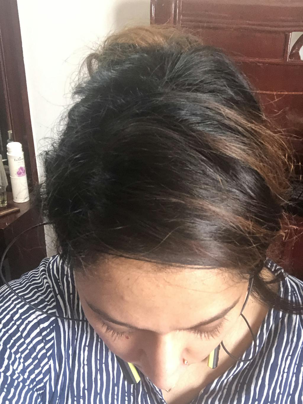 Side Patches Hair Extensions In India Invisible Side Patches 1 Hair