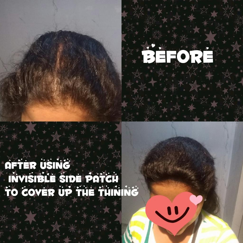 Side Patches Hair Extensions In India Invisible Side Patches 1 Hair