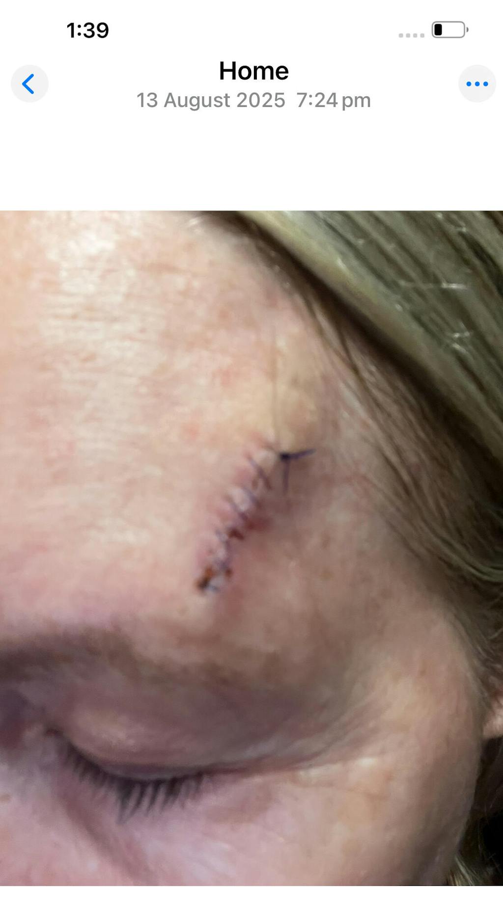 Sun Repair Starter Pack