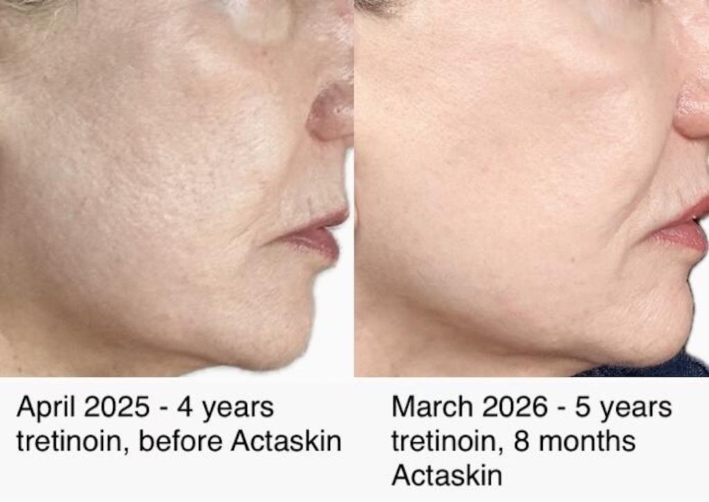 Sun Repair Supplement