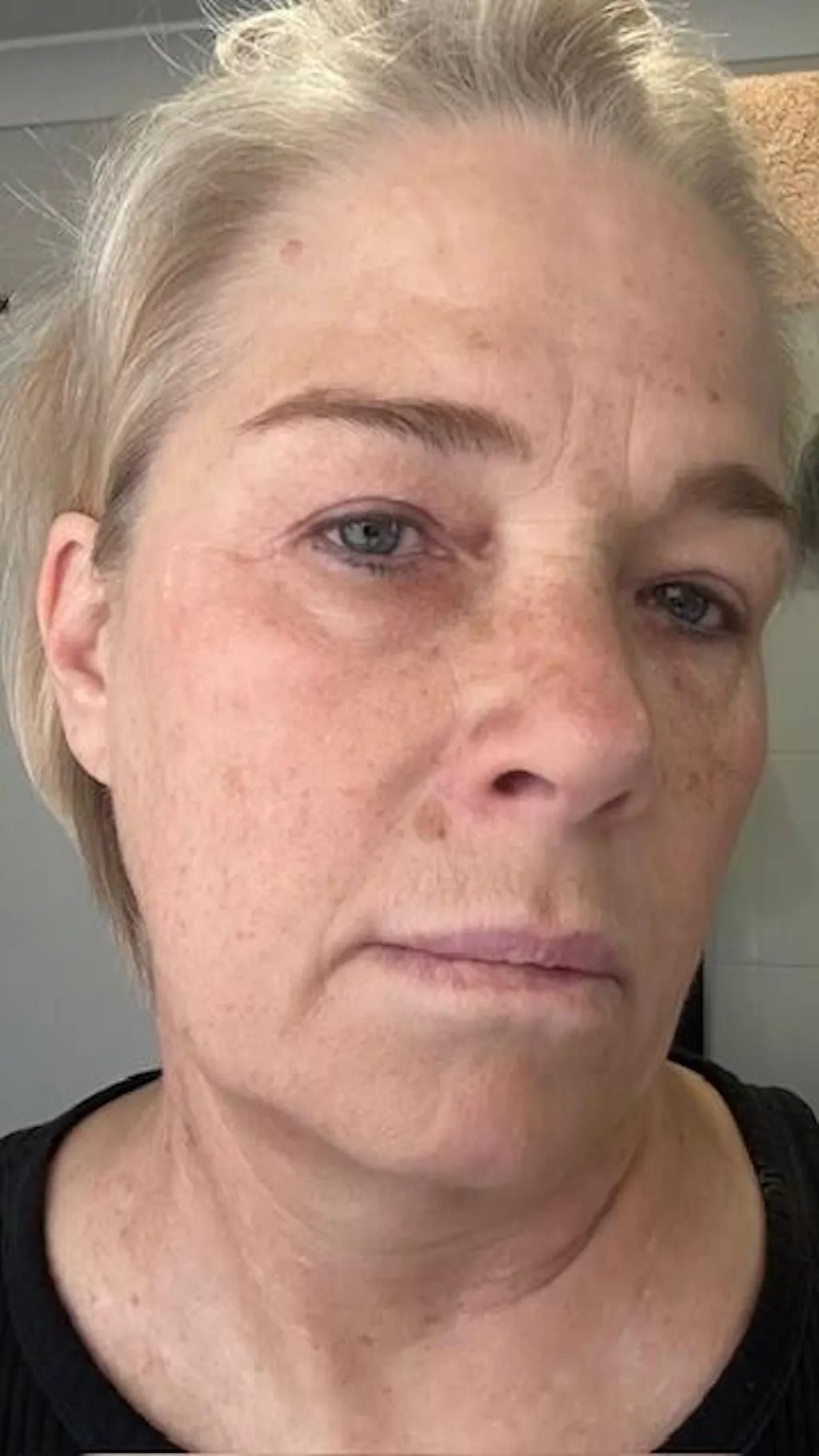 Sun Repair Supplement