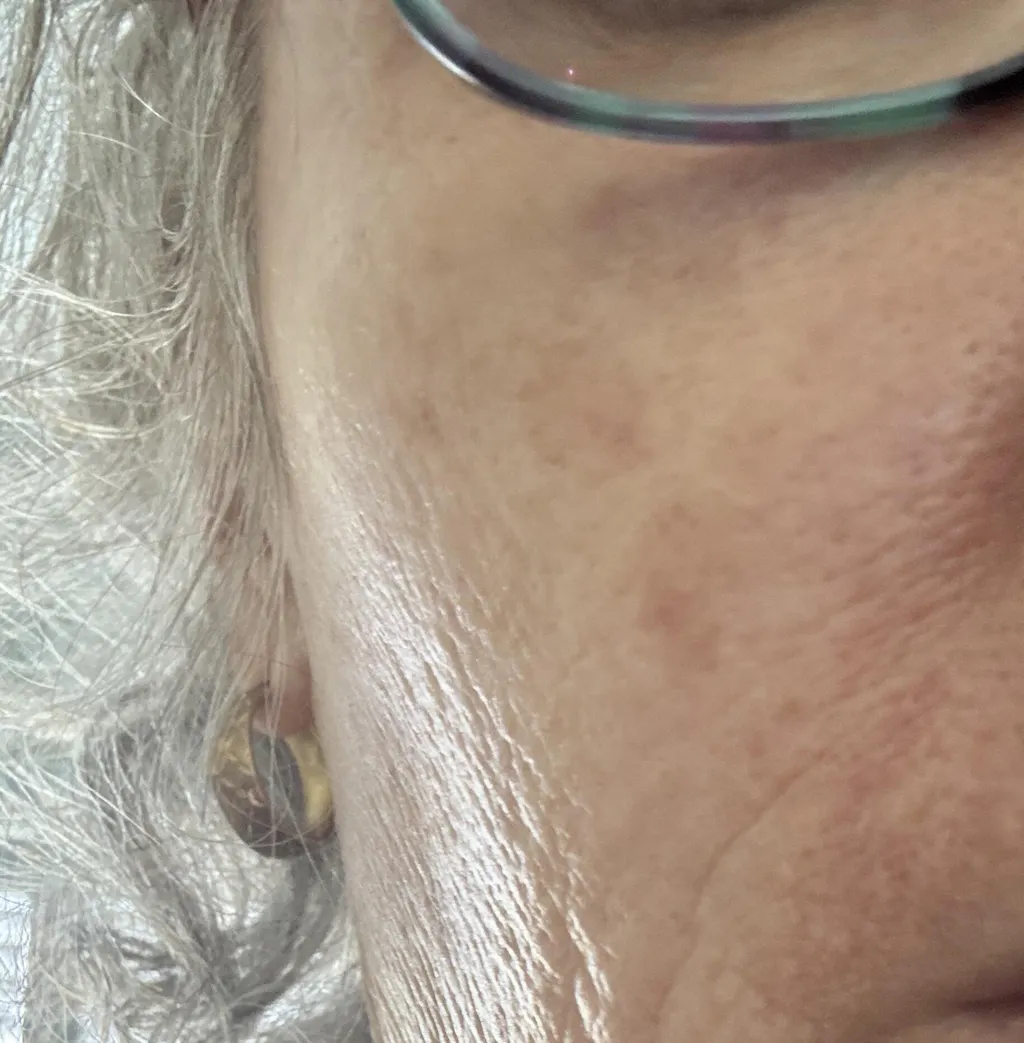 Sun Protect Sunscreen