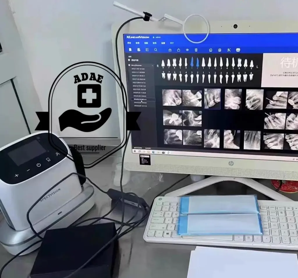 Xpect Vision XVbeam2000 Handheld Dental X-Ray Machine