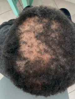 Review picture