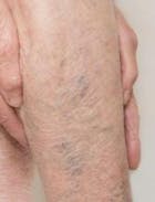 RELAX FEET® - MASAJE PROFESIONAL (EMS)