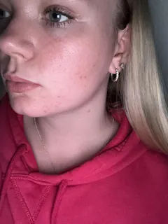 Review picture