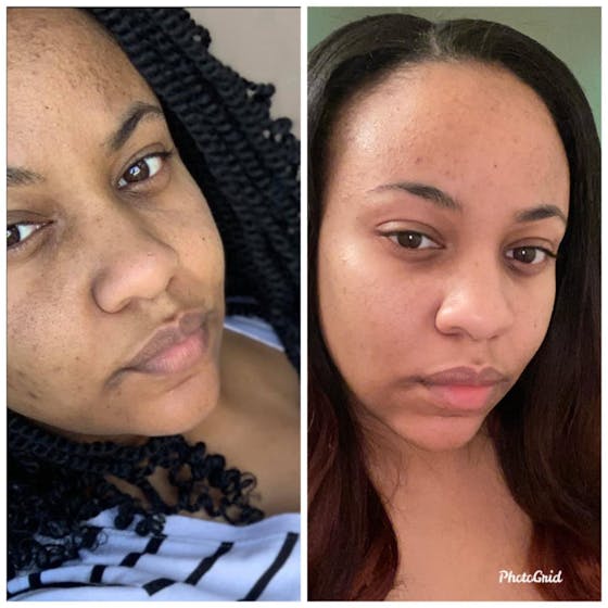 Natural Classic Kojic Acid Handmade Soap (2 Pack)