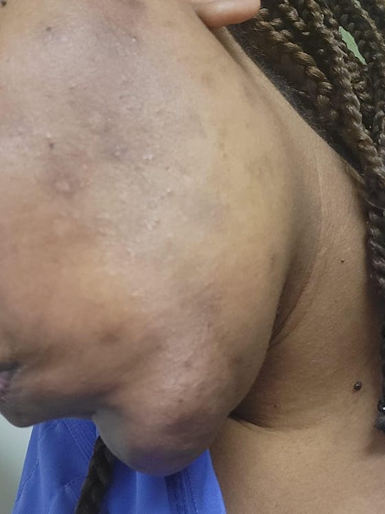 Lemon Turmeric & Kojic Acid Brightening Soap (Gift Set)