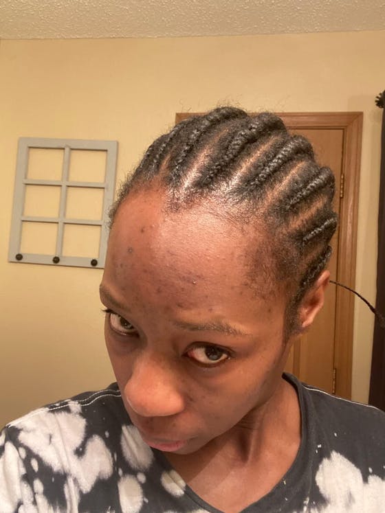 Lemon Turmeric & Kojic Acid Brightening Soap (Gift Set)