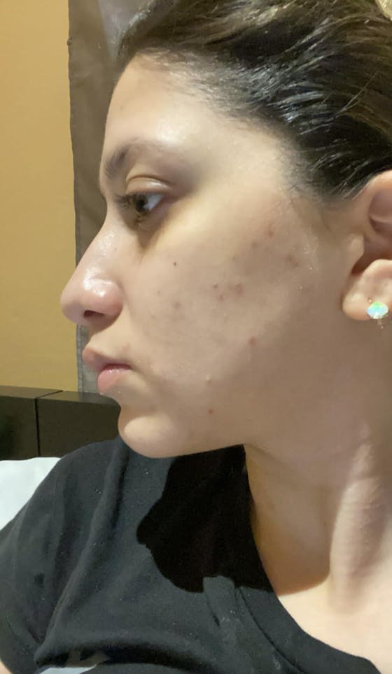 Turmeric Lemon Kojic Acid Soap