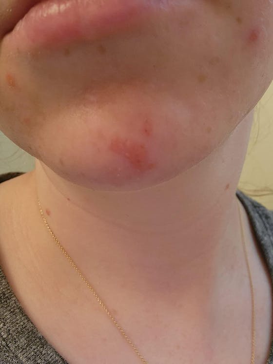 Turmeric Lemon Kojic Acid Soap