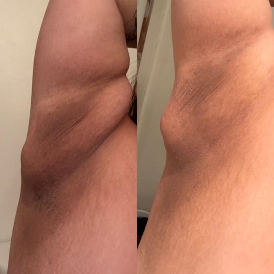 Turmeric Lemon Kojic Acid Soap