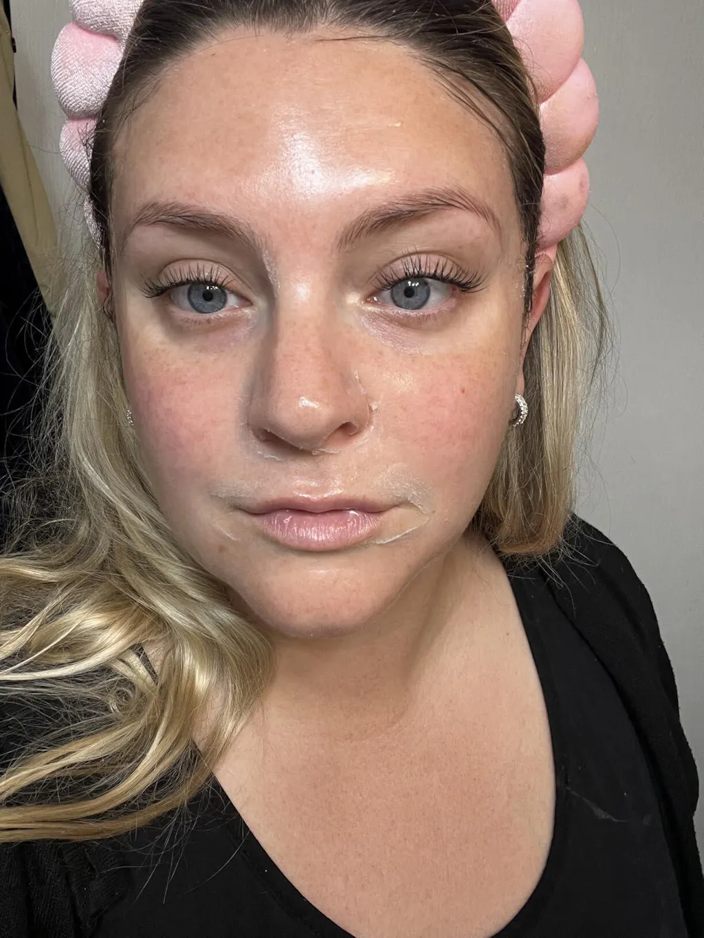 Monica before and after