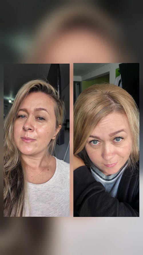 Tratamiento de Aclarado Progresivo ANHELI