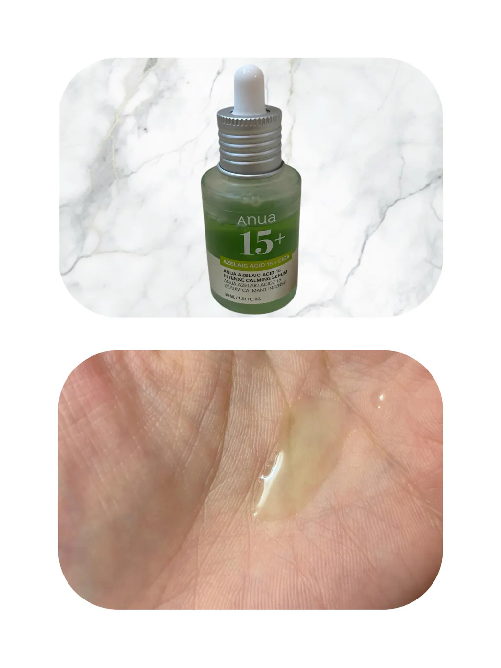 アゼライン酸15インテンスカーミングセラム 30ml – アヌア Anua
