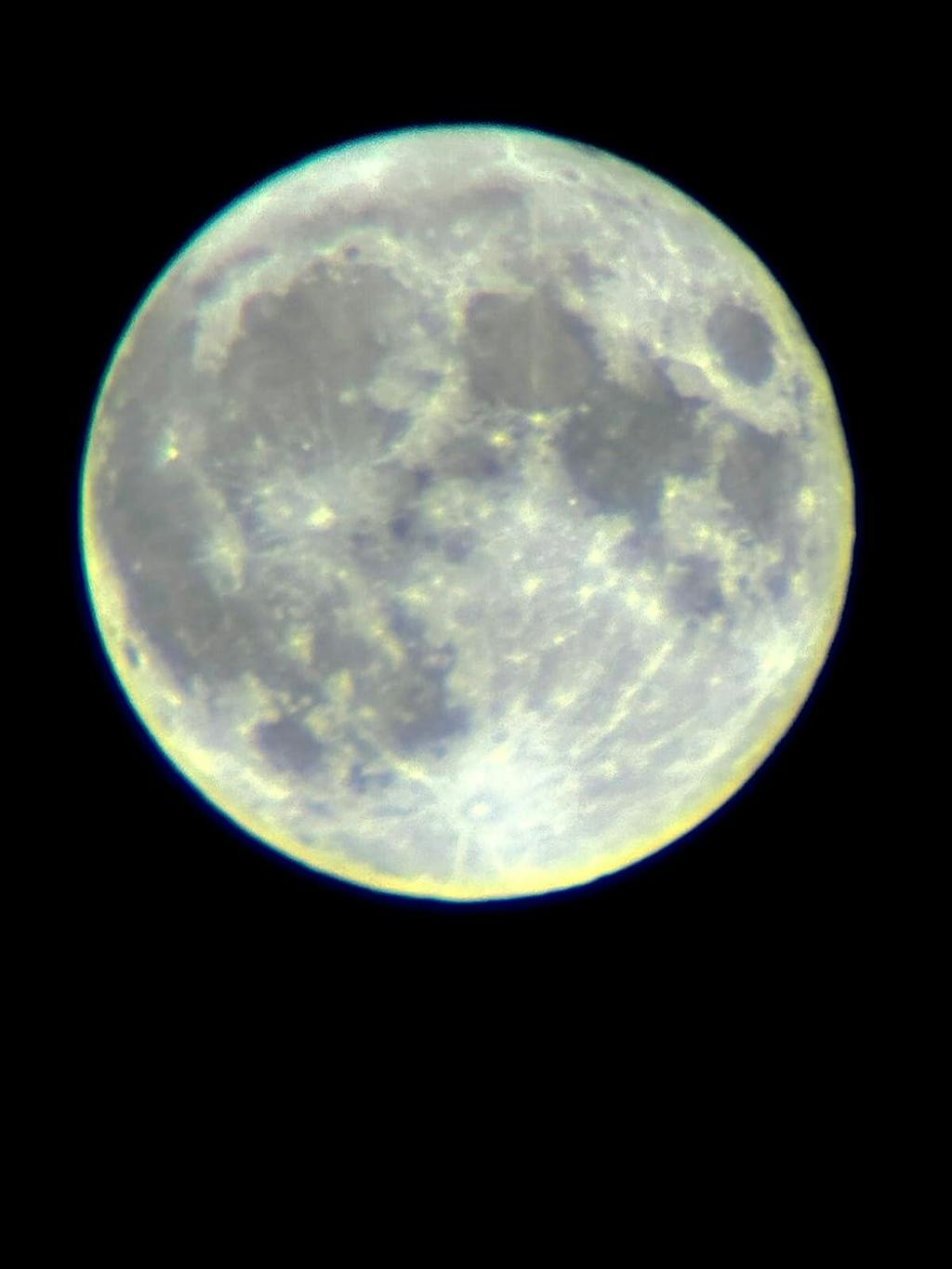 Enhanced Zoom 20-40X Smartphone Telephoto Lens Kit