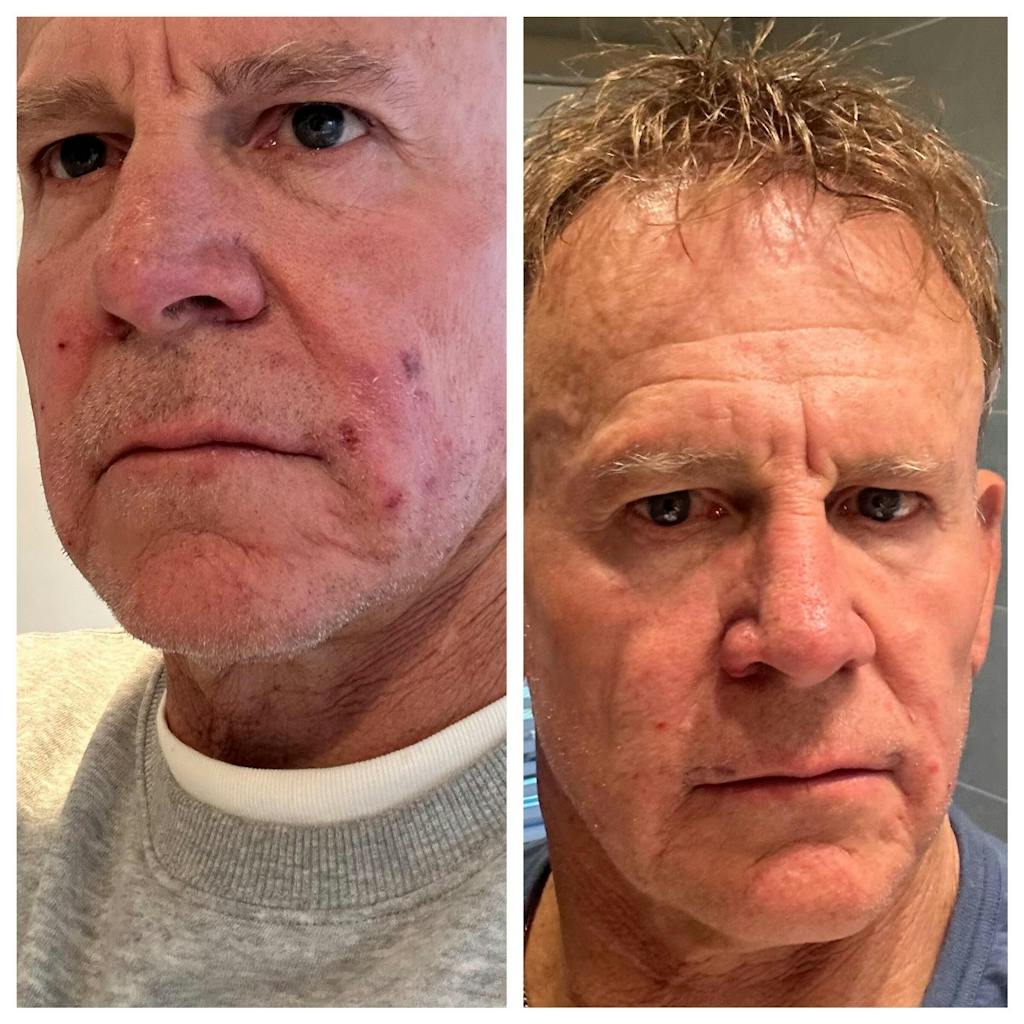 Skin Sidekick™ Satin Pillowcase