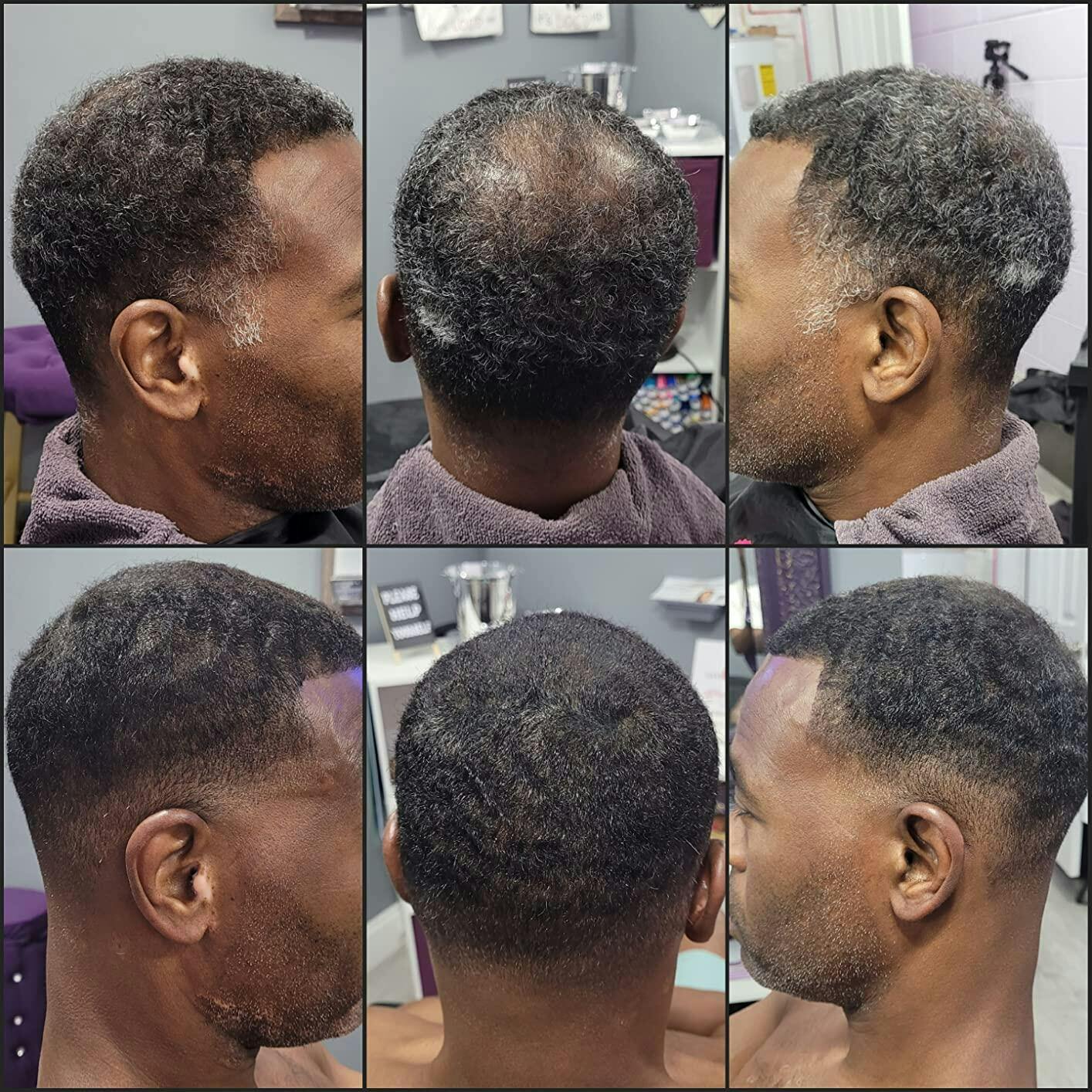 Hair Building Fibers Arhgoat Hair Building Fibers Arhgoat