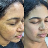 Serum Cúrcuma · Calma y Unifica el Tono de la Piel