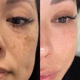 Serum Cúrcuma · Calma y Unifica el Tono de la Piel