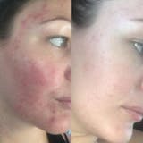 Serum Cúrcuma · Calma y Unifica el Tono de la Piel