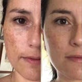 Serum Cúrcuma · Calma y Unifica el Tono de la Piel