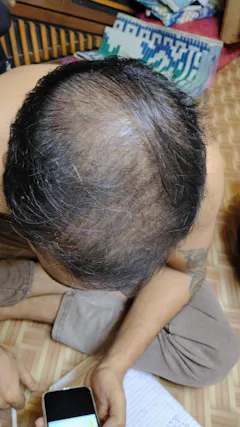 Review picture