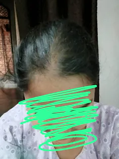 Review picture