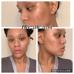 Review picture