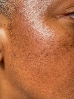 Pumpkin Enzyme Masque - Instant Glow