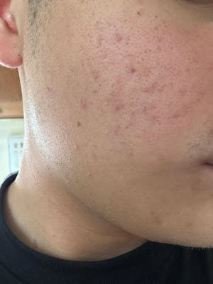 Pumpkin Enzyme Masque - Instant Glow