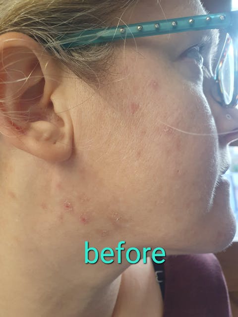 Dry/ Mature Nourishing Skincare Set For Sensitive Skin