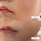 BEBELUNA Mild Lotion 7.05 oz – 98% Natural Ingredients, Elderflower & Centella, Gentle Moisturizer for Sensitive Skin