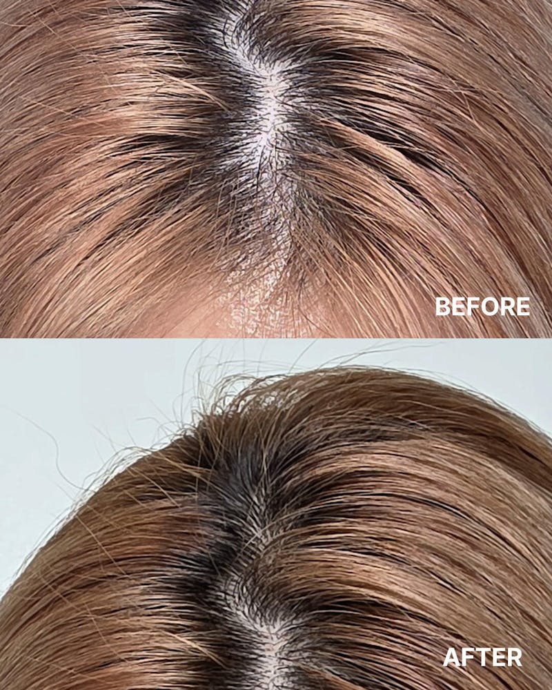 Luna:H Scalp Shampoo – Functional Hair Loss Care, Menthol Cooling, Peptide & Plant-Based Complex, 16.9 fl oz (500ml)