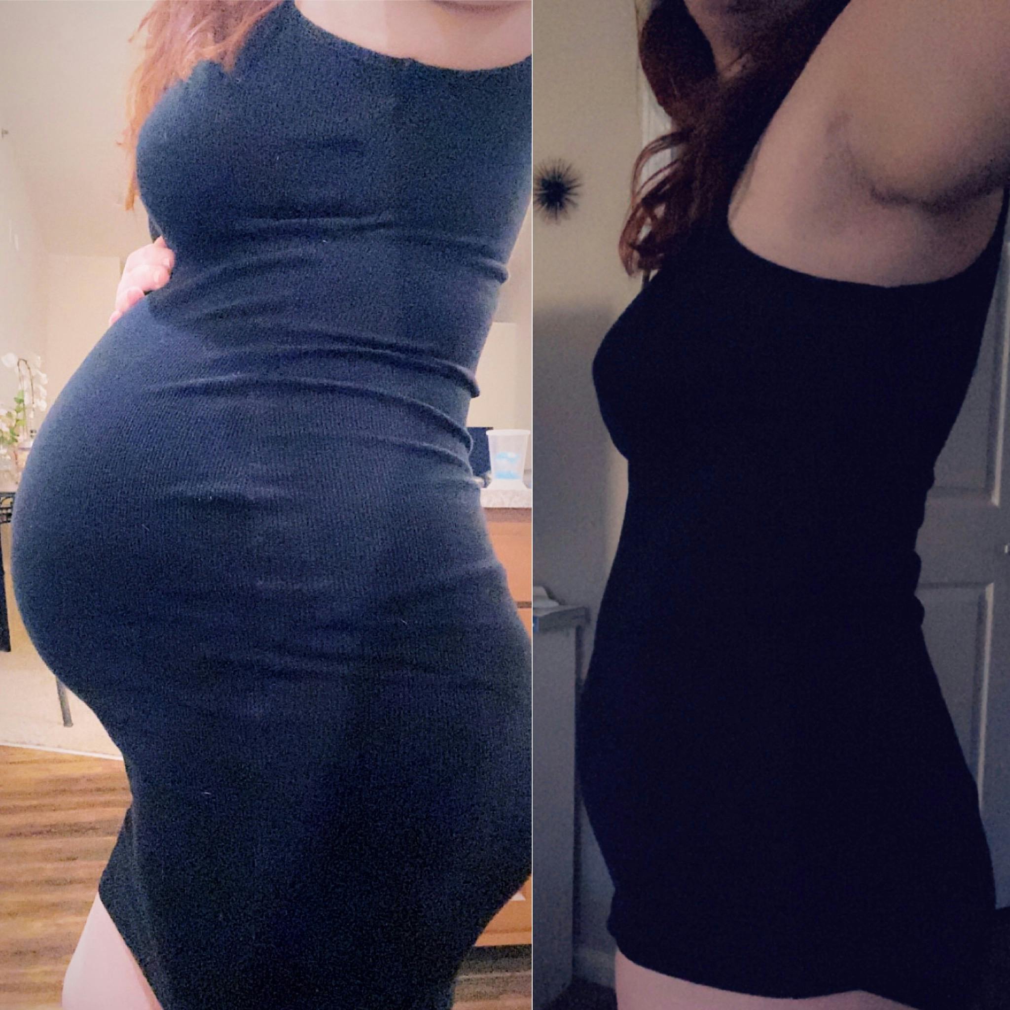 Luxe Belly Wrap Belly Bandit