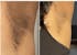 Gant exfoliant en soie - Corps + visage OFFERT