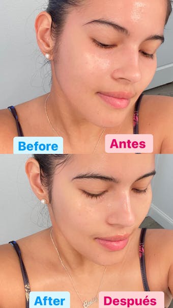 Goodbye Redness Centella Gel 100g