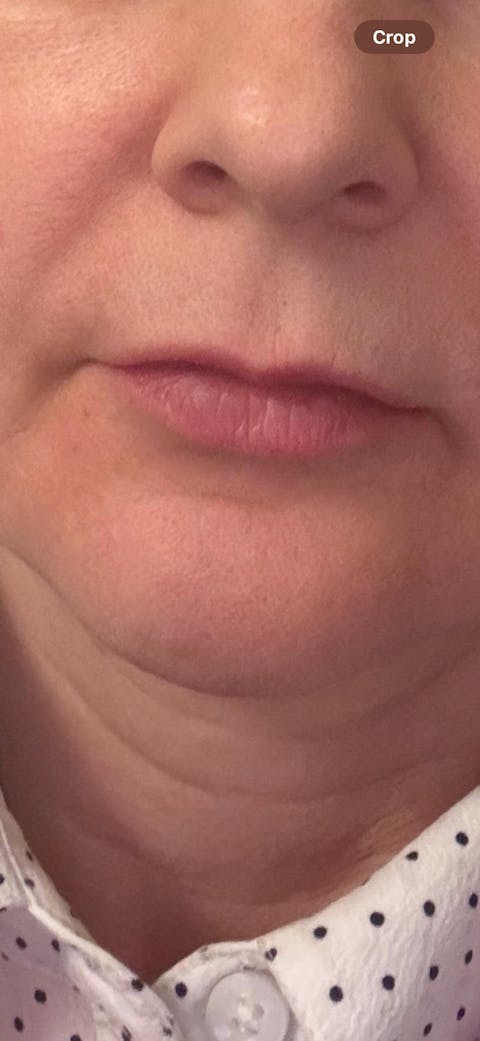 Natural Face Lift Massage Workshop