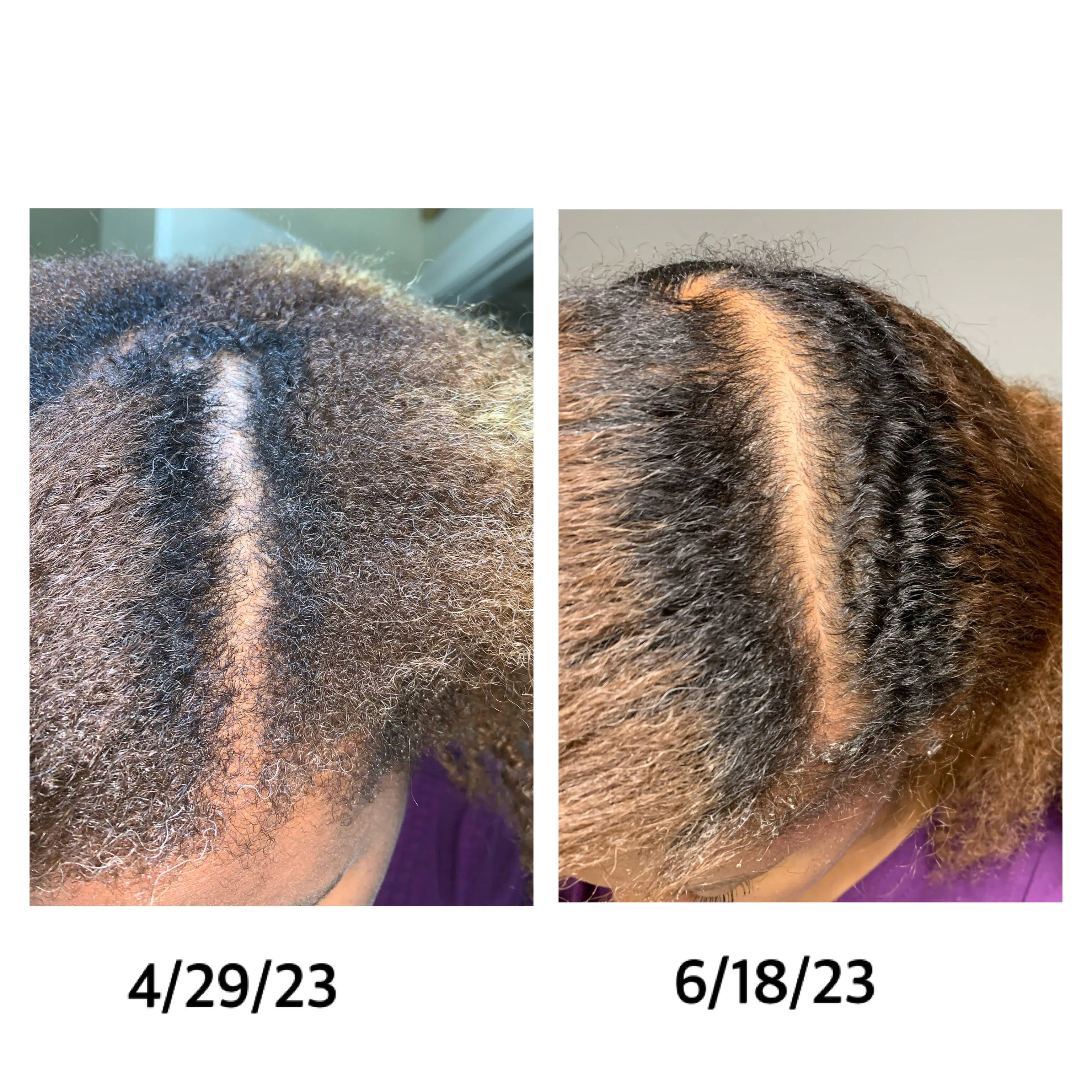 RAPID REMEDY HAIR GROWTH OIL – Blossom Cosmetics