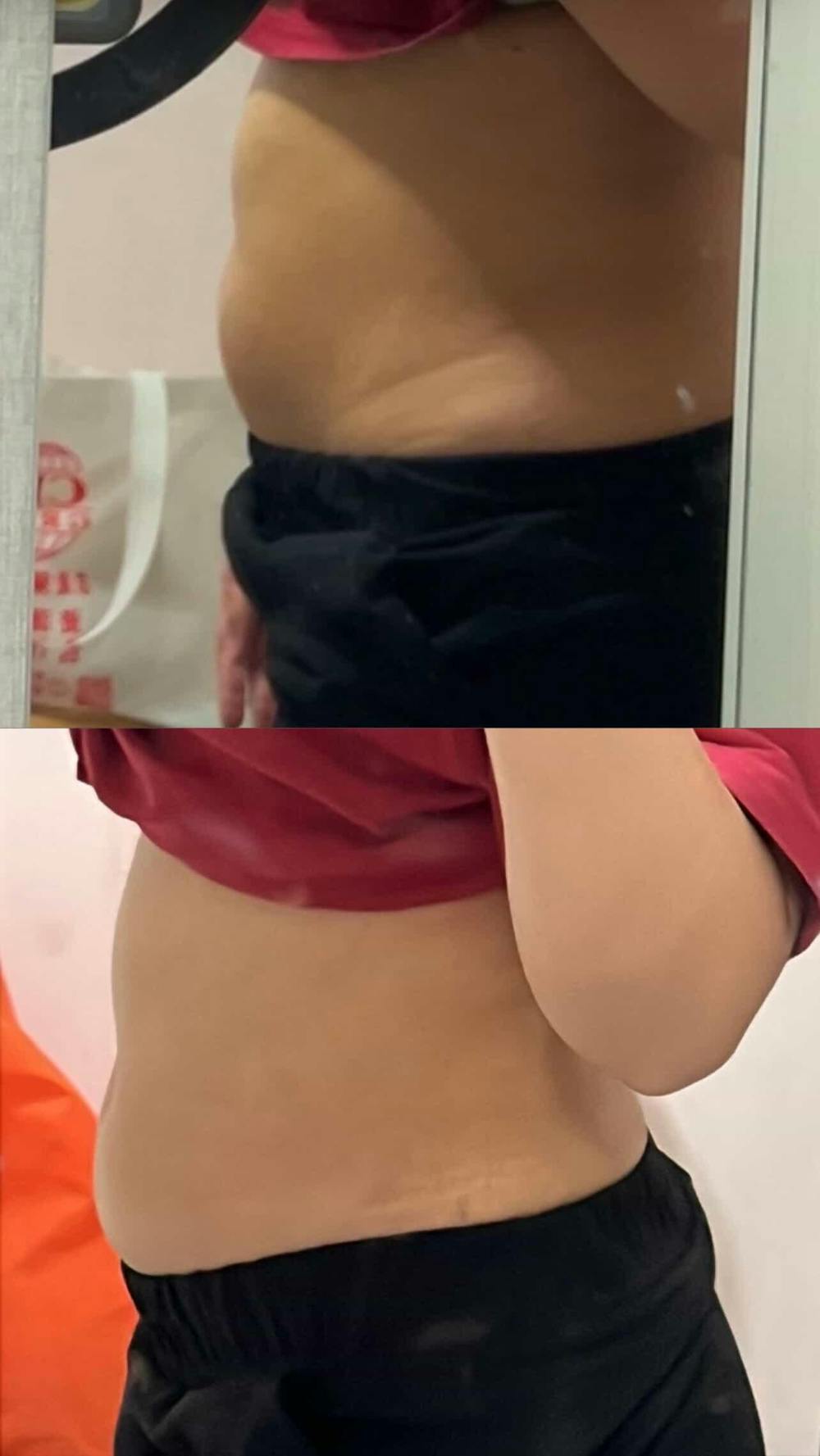 MORI Fix+ Relaxing Firming Massage Gel 50mlx2 (Singapore)