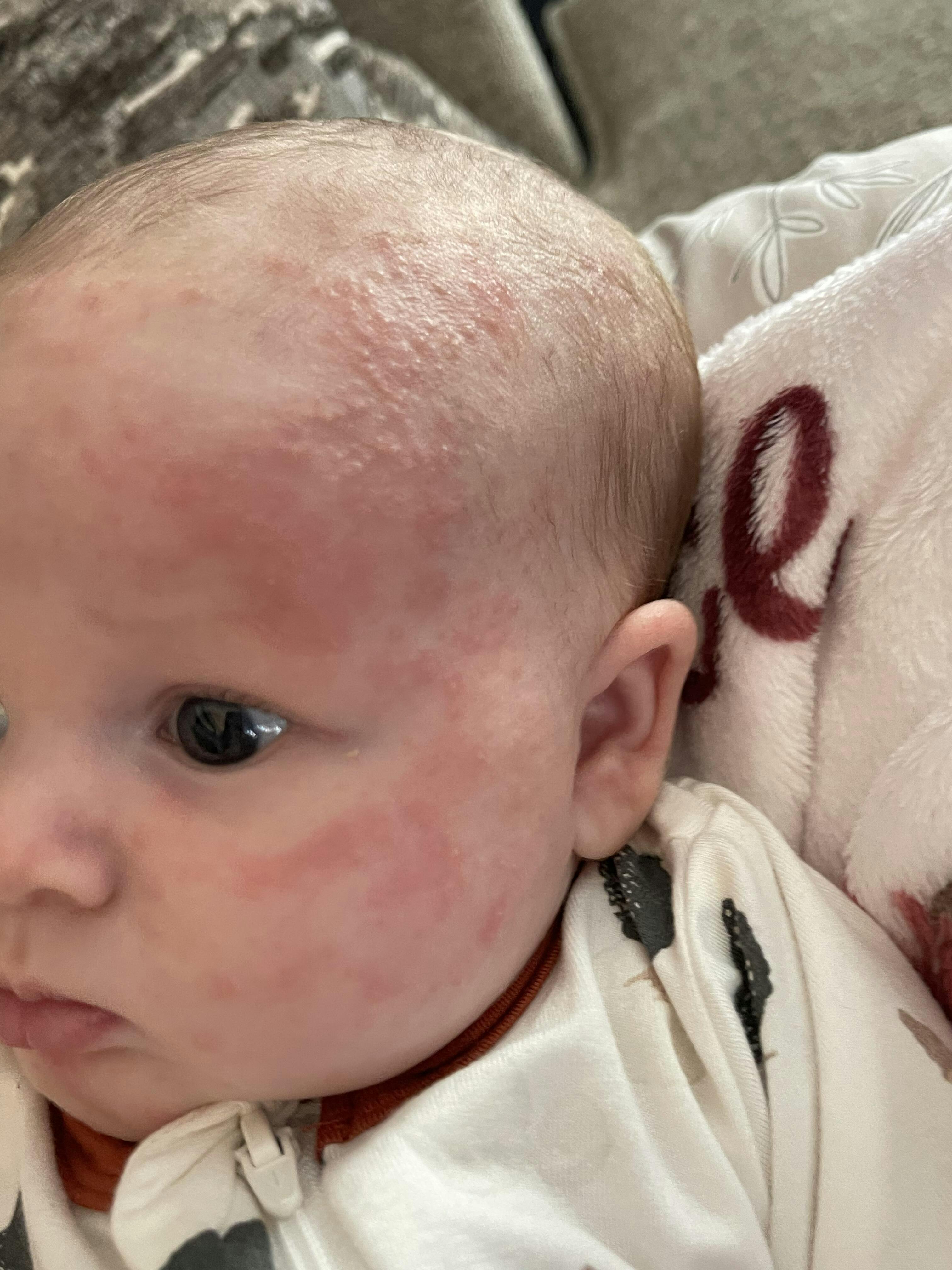 Coconut Oil Cradle Cap Duo Bubbsi