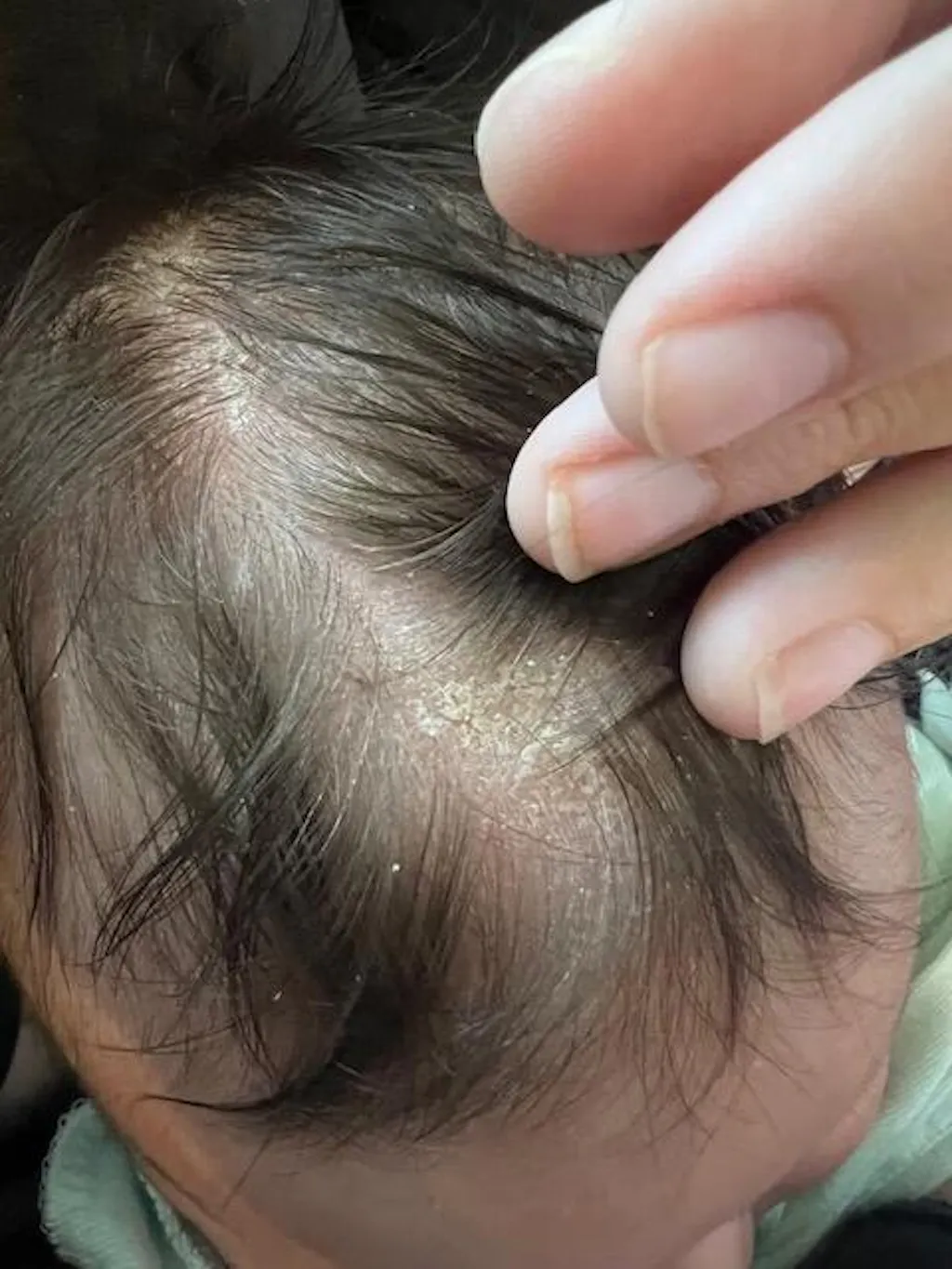 Coconut Oil Baby Hair Products for Dry Scalp and Dry Skin Bubbsi