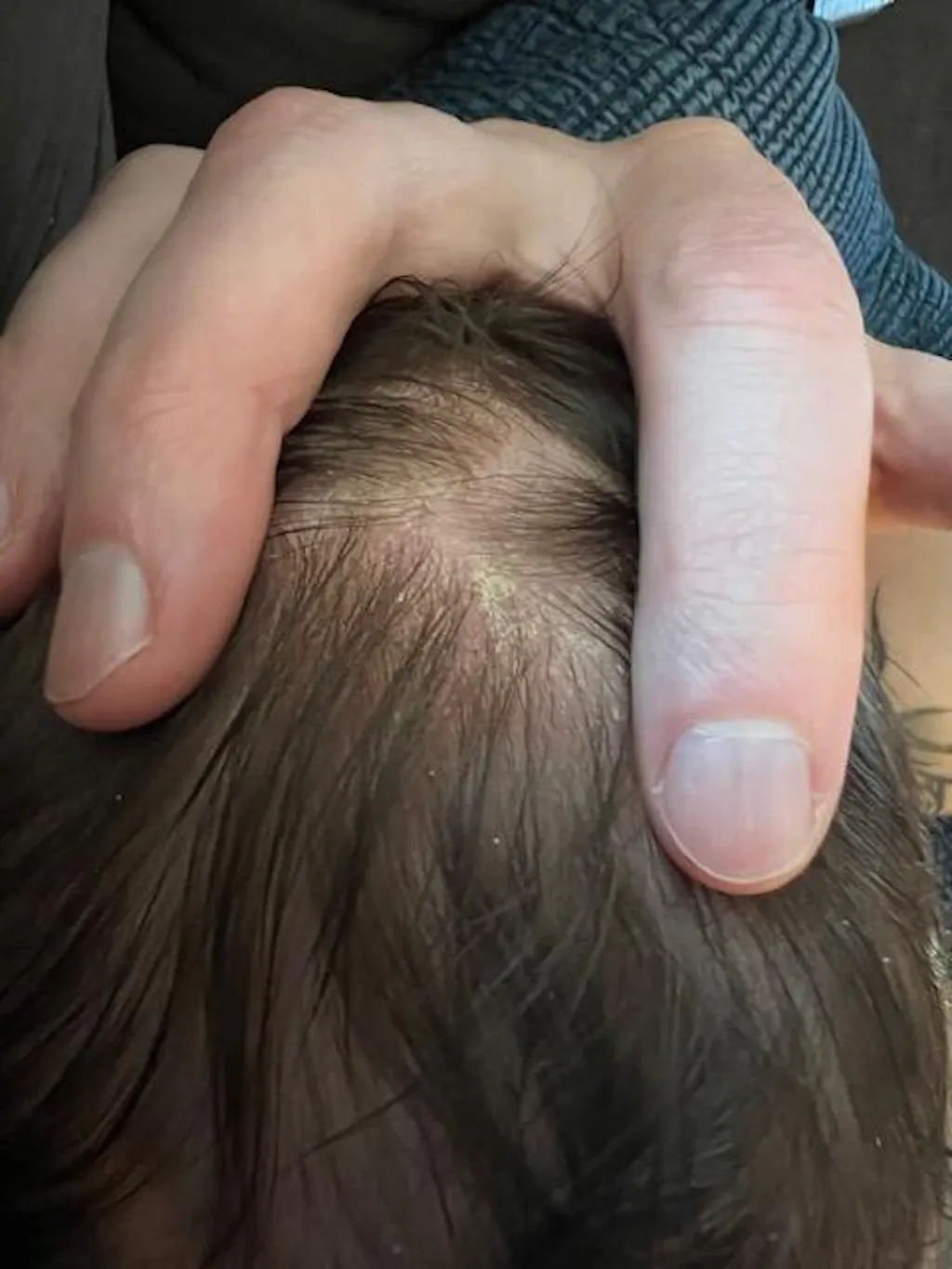 Coconut Oil Baby Hair Products for Dry Scalp and Dry Skin Bubbsi