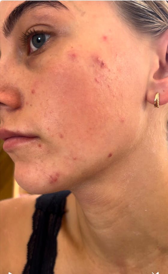 JEJU ISLAND PEPTIDE BARRIER SERUM