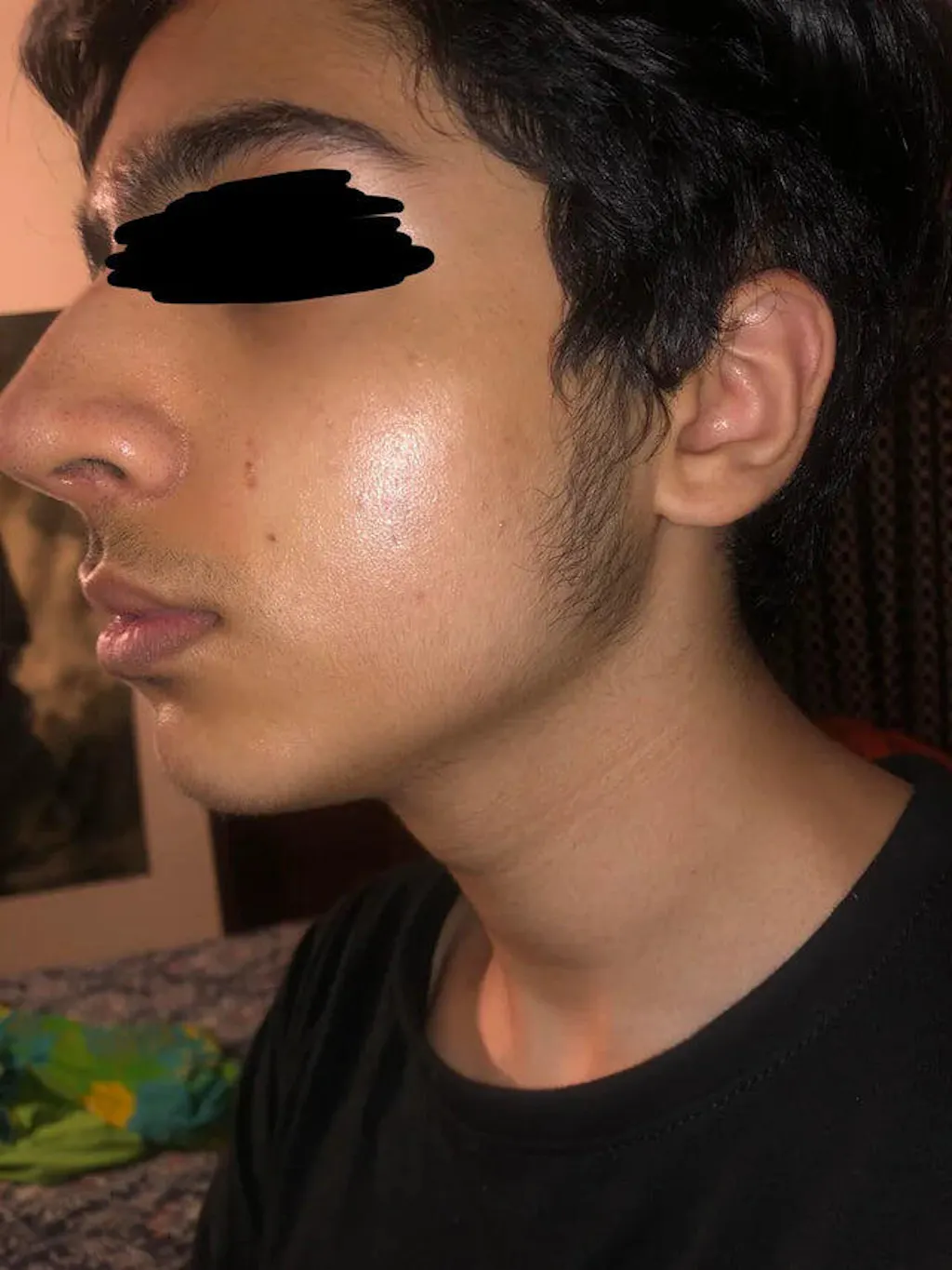 Anti Acne Duo