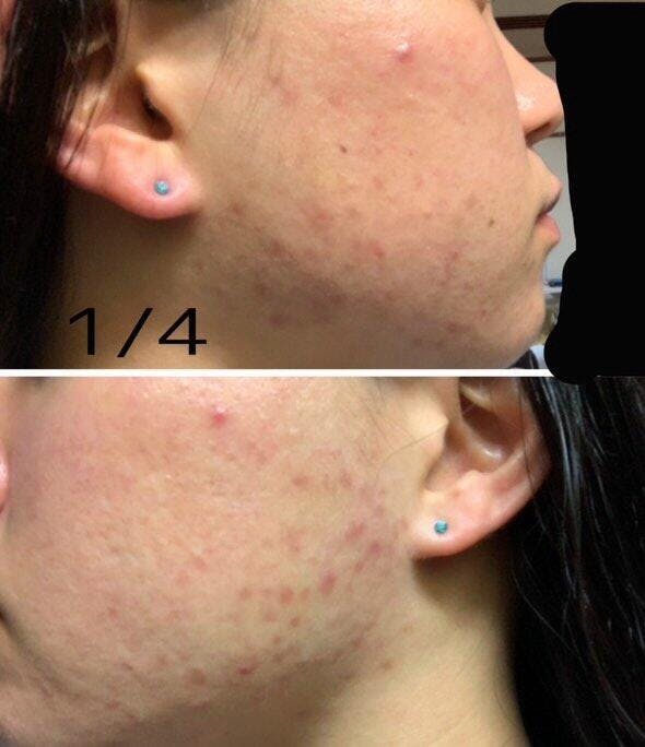 AQUA MOIST CALMING TONER – CAROME.