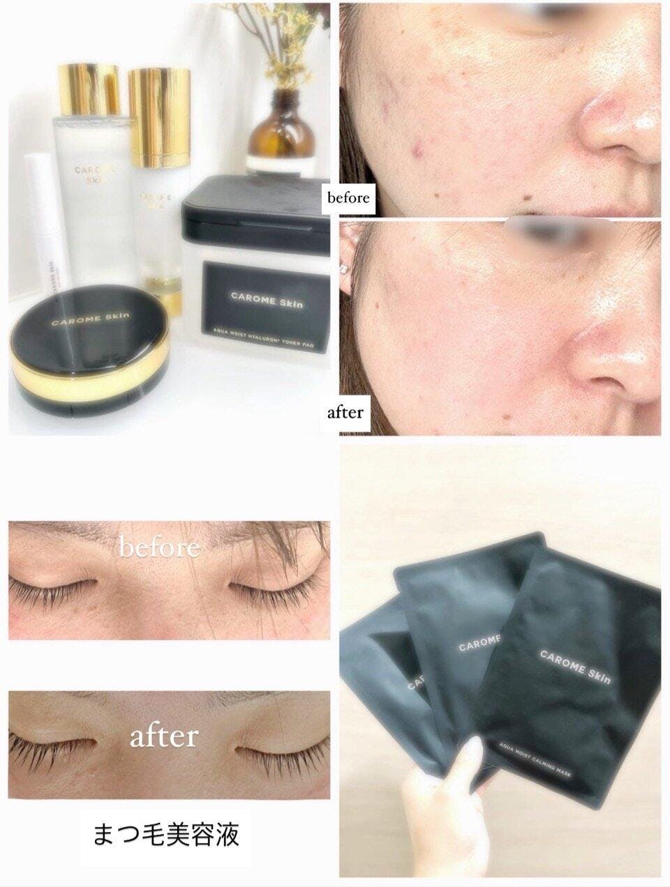 AQUA MOIST CALMING TONER – CAROME.