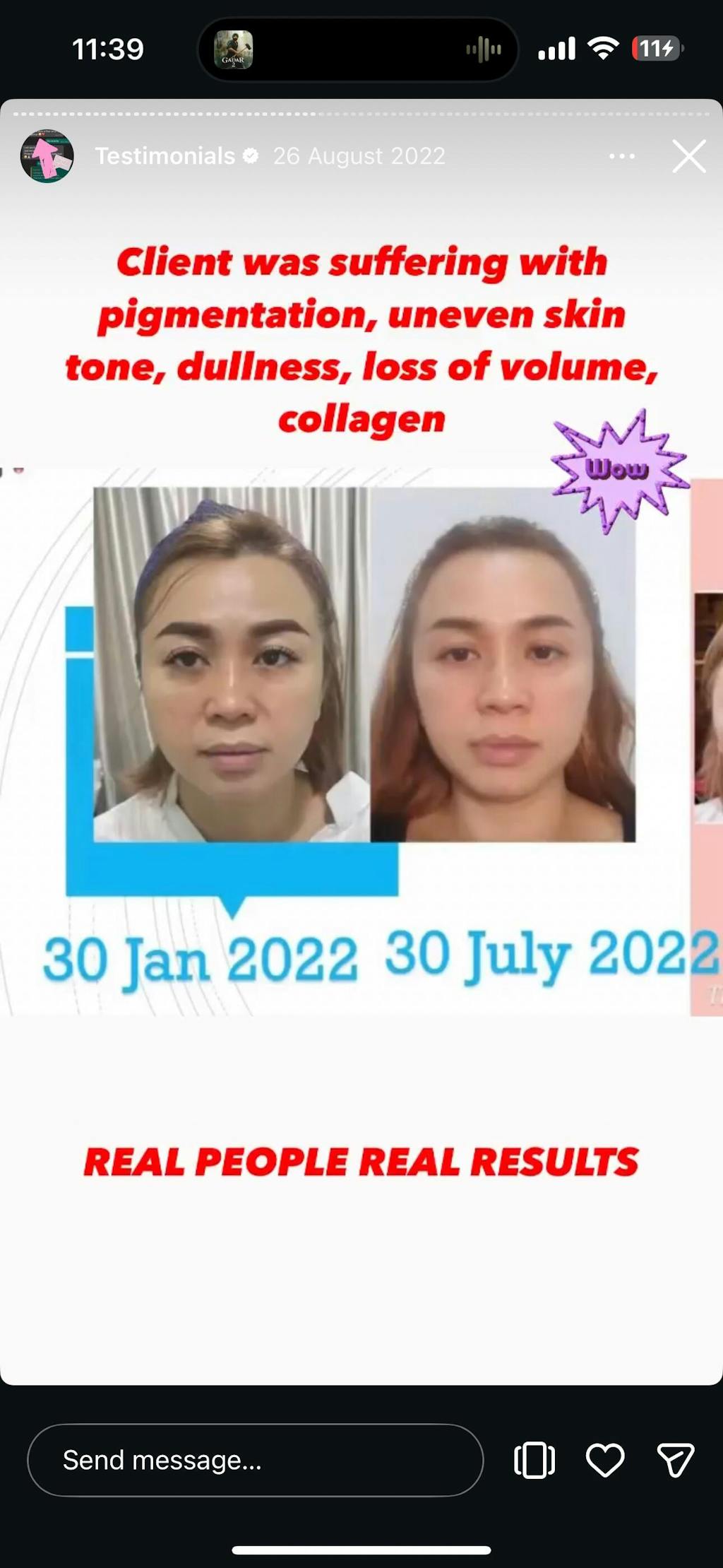 Dr Sys Contour Capsule Cream – Cellglow Skincare