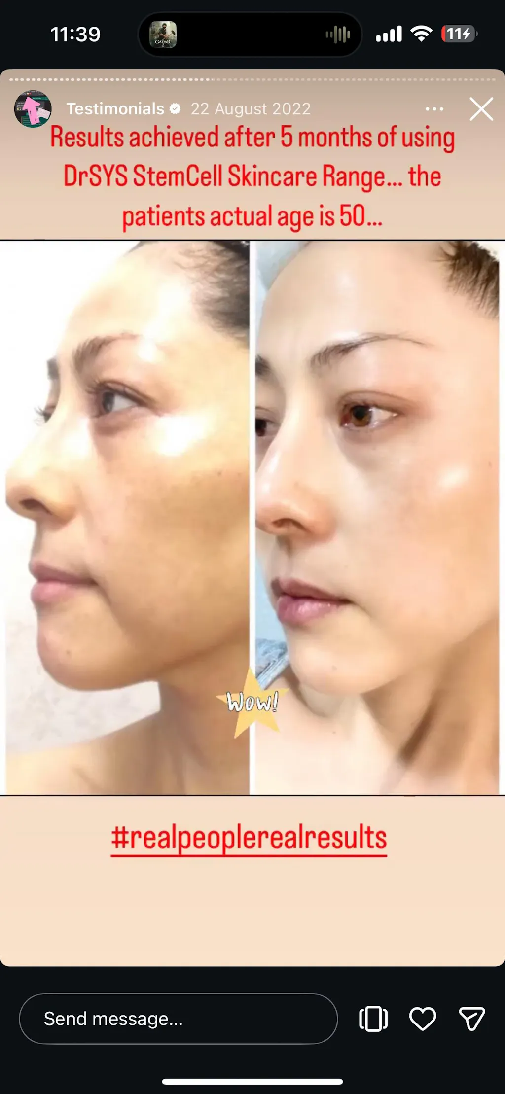 Dr Sys Contour Capsule Cream – Cellglow Skincare